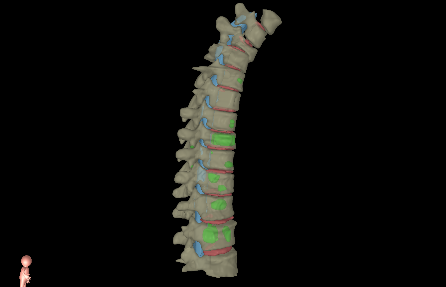 Spinal Metastases Treatment in New Jersey | Jonathan H. Sherman, MD